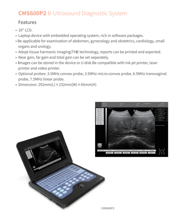 CMS600P2 B-Ultrasound Diagnostic System